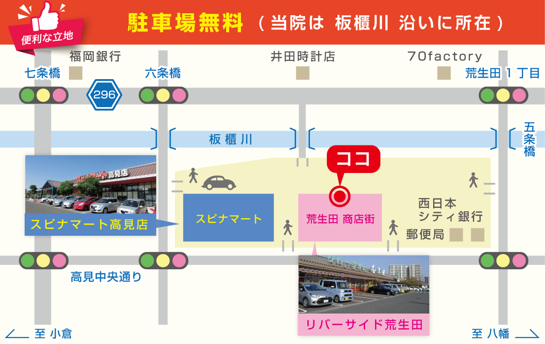 地図イラスト | しま整骨院 | しま整体院 | SST（しまスパインチューニング）| 北九州八幡東区高見 | スピナマート高見店のお隣